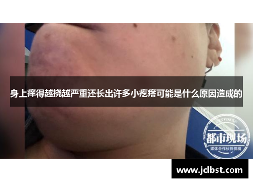 身上痒得越挠越严重还长出许多小疙瘩可能是什么原因造成的